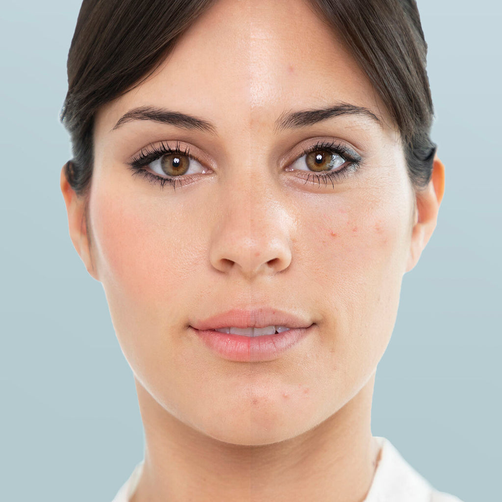 GlowSkin – Sauna Facial de Vapor Profesional
